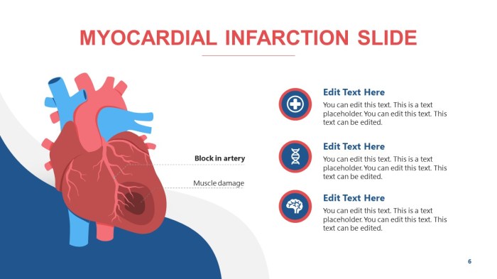 Myocardial infarction system disorder template